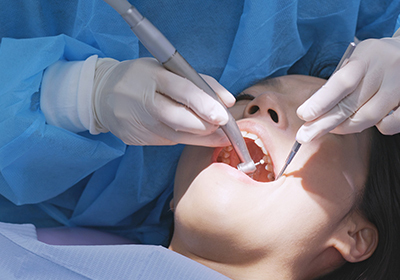 歯周病の治療方法